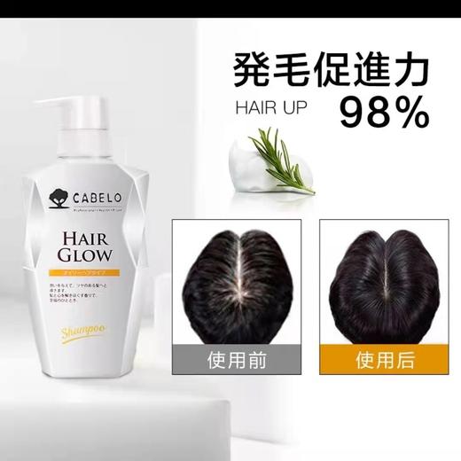 【中欧班列】日本进口 卡蓓诺 防脱发护发素 男女 （油性脱发）350ML/瓶 hm 商品图4