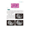 泌尿外科疾病影像及病理图解 尚东浩 王大业 涵盖泌尿系统疾病50余种 系统全面的介绍了临床常见和少见的泌尿系统疾病人民卫生出版社 商品缩略图4