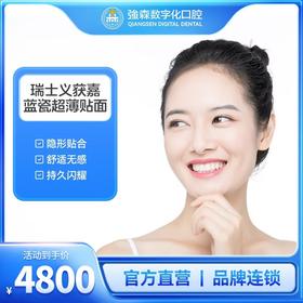 瑞士义获嘉蓝瓷超薄贴面