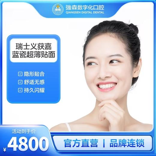 瑞士义获嘉蓝瓷超薄贴面 商品图0