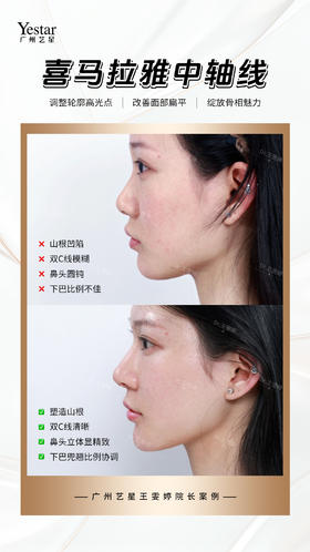 骨相修容，塑造中轴美学曲线🧏‍♀️
