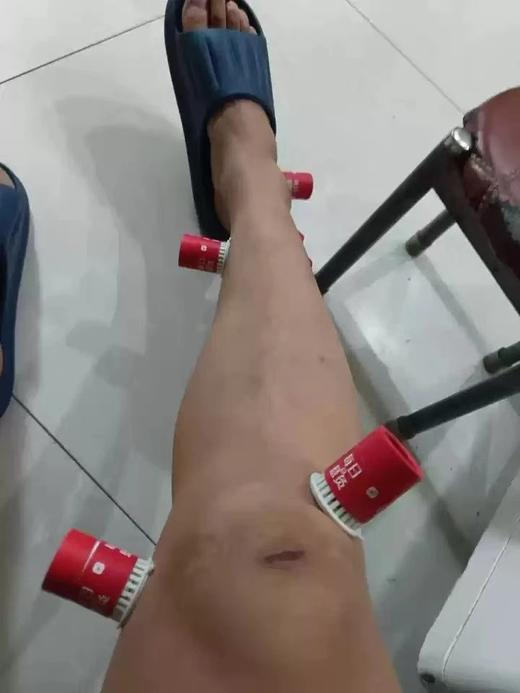 元19.9起兰序每日悬灸便携微烟小悬灸口袋里的艾灸师在家就可以，陈艾渗透力超强可循环使用非市面上一次性的灸具基地直邮 商品图9