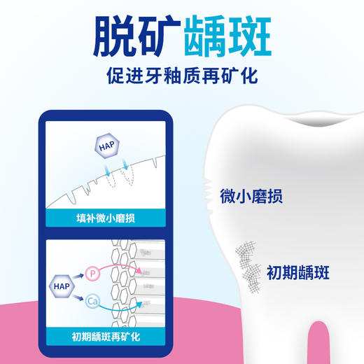 【店铺上新】DENT防龋牙膏135g 商品图2