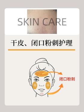 闭口歼灭攻略❗赶快点赞收藏❗