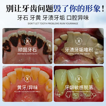 BAILUHUI美白牙膏小苏打去口臭去黄去牙结石去牙渍亮白热销金榜第一名 /个人护理 /口腔护理 /牙膏 商品图4