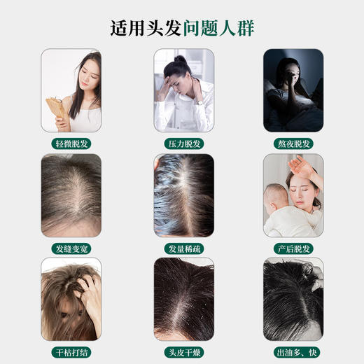 热卖中！！【53项专利 科学防脱50年 国妆特字】章光101防脱香波洗发水 360g/瓶 买2瓶装送8g*5袋旅行装！ 商品图5