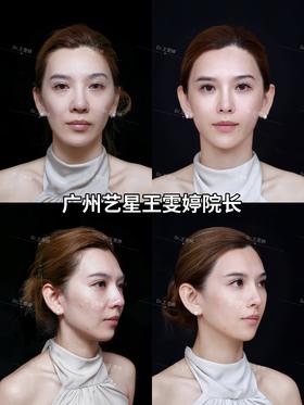 抗衰的意义不是换头‼