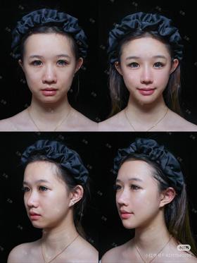 原生幼态脸没事别随便做‼️不然有你后悔的