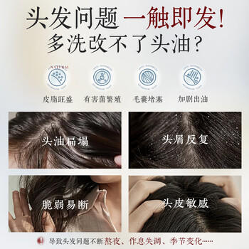 UIJO有觉控油蓬松洗发水专用去屑止痒香氛持久留香男女洗头膏露洗发液金榜 /个人护理 /洗发护发 /洗发水 商品图7