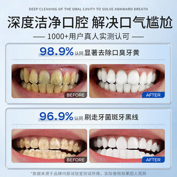 BAILUHUI美白牙膏小苏打去口臭去黄去牙结石去牙渍亮白热销金榜第一名 /个人护理 /口腔护理 /牙膏 商品图5