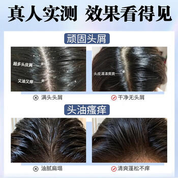 宫本武藏二硫化硒去屑洗发水脂溢性去屑止痒控油毛囊清洁洗发水痘300ml /个人护理 /洗发护发 /洗发水 商品图4