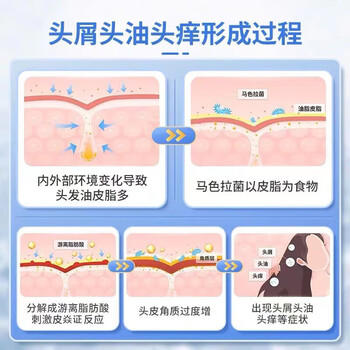 宫本武藏二硫化硒去屑洗发水脂溢性去屑止痒控油毛囊清洁洗发水痘300ml /个人护理 /洗发护发 /洗发水 商品图2