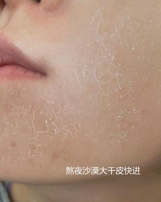 Oposi黄芪玻尿酸补水祛黄面膜 商品图2