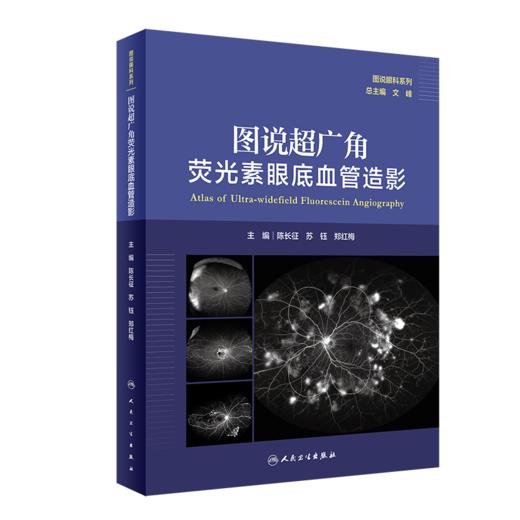 全2册 图说超广角荧光素眼底血管造影+图说视觉电生理（图说眼科检查系列）OCT眼底病检查技术OCTA视网膜眼科医学类书籍 商品图2