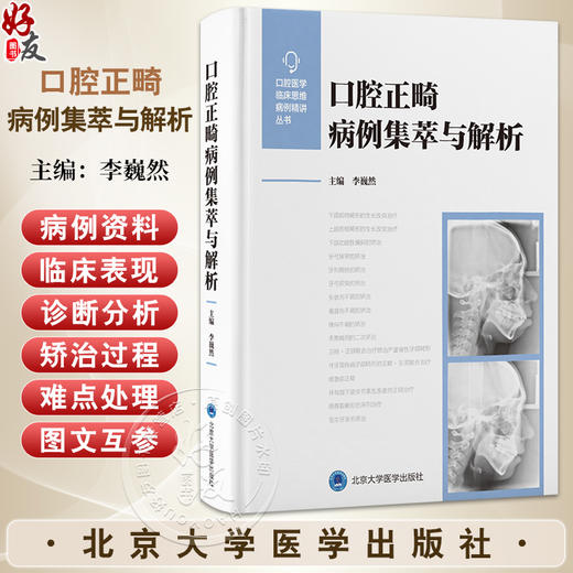 口腔正畸病例集萃与解析 李巍然主编 全面系统的对各类错 畸形的正畸治疗进行介绍 口腔学书籍 9787565934155 北京大学医学出版社 商品图0