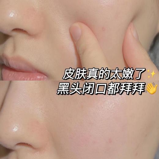 【5分钟净透肌肤堪比吸尘器】子初控油净肤清洁泥膜 200g/盒 商品图2