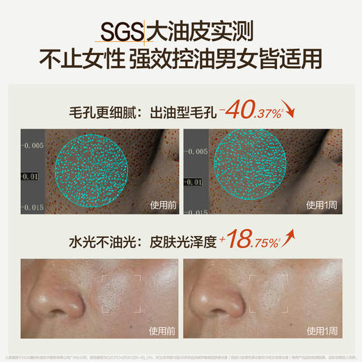 【新品上市】HBN控油精粹水祛痘舒缓细毛孔爽肤水湿敷化妆水 商品图2