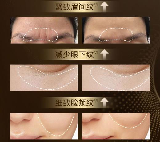 优力诗抗皱保湿舒缓霜NMN 6瓶装 商品图2