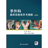 手外科临床思路及手术图解（第2版） 商品缩略图1