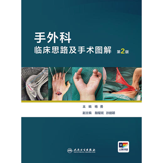 手外科临床思路及手术图解（第2版） 商品图1