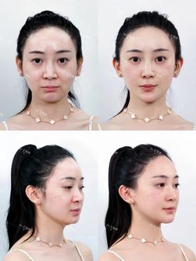 年龄🈵30减10✨了解下疲态显老脸消失术☑