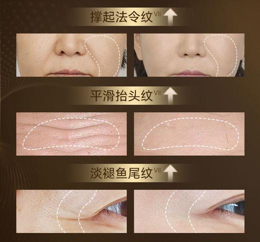 优力诗抗皱保湿舒缓霜NMN 6瓶装 商品图3