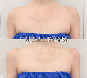 ✅立马get秒变「人间衣架」