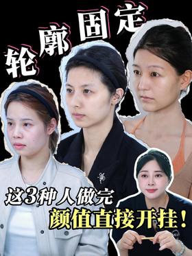 这3️⃣类人做轮廓固定...颜值直接开挂❗️