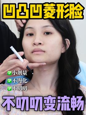 凹凸凹菱形脸，不叨叨变流畅，看看王院如何改造