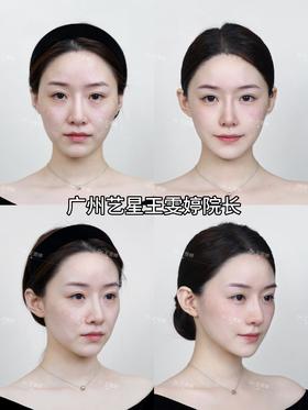 百万粉丝美妆博主远道而来找婷院变美🌟🌟