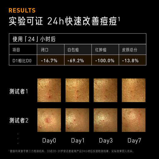 水杨酸缓释凝胶 商品图1