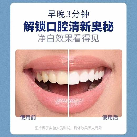 【全新配方升级】资韩堂 幽门螺旋杆菌口腔抑菌膏 120g/盒 商品图4