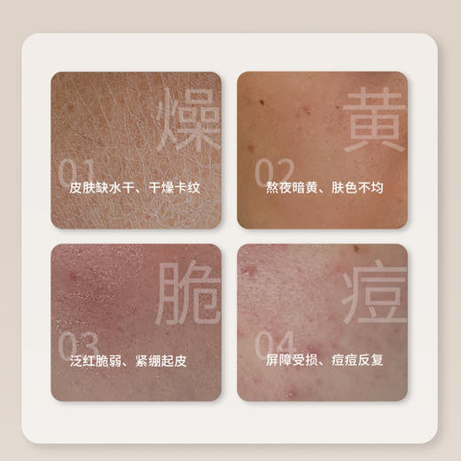 本活灯泡肌美白祛斑套盒四件套美白淡斑提亮肤色改善暗沉暗黄 商品图1