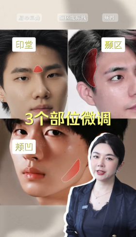 宝子们！想微调又怕变 “假脸” 的看过来～