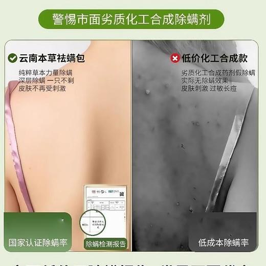 云南本草除螨包 植物草本 床上用防螨虫包 衣柜神器床垫贴去除蝻剂 12袋/盒 商品图1