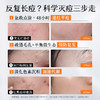 【油痘肌】胶态硫祛痘精华液2ml 控油去粉刺痘痘，舒缓修护 商品缩略图1