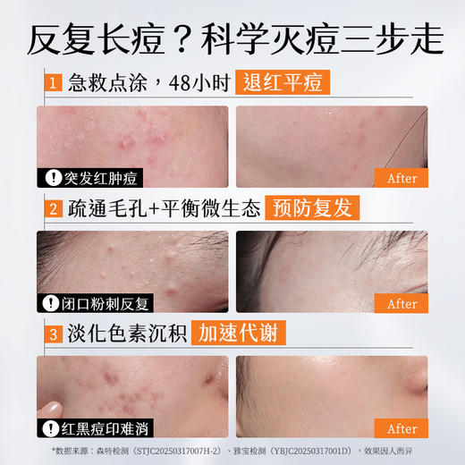 【油痘肌】胶态硫祛痘精华液2ml 控油去粉刺痘痘，舒缓修护 商品图1