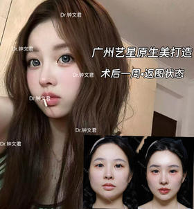 ✨微调轮廓+软组织年轻化=自然妈生感 💌不肿不僵，次日就能自信赴约！