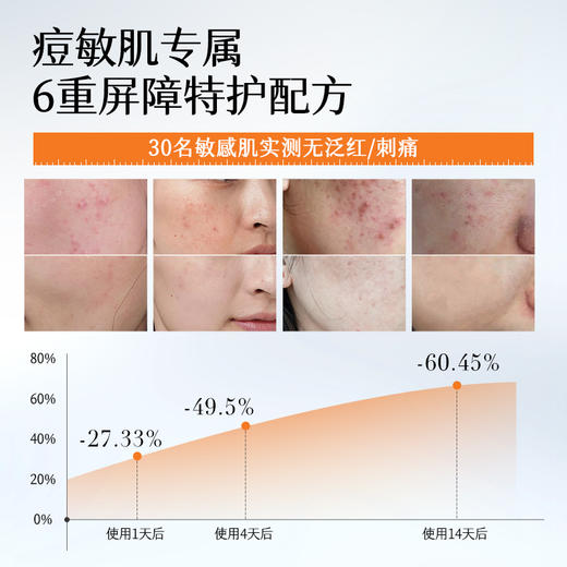 【油痘肌】胶态硫祛痘精华液2ml 控油去粉刺痘痘，舒缓修护 商品图3