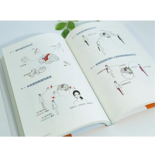 手绘极简神经疾病定位诊断 商品图4