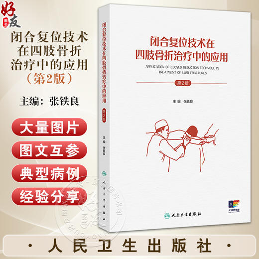 闭合复位技术在四肢骨折治疗中的应用 第2二版 张铁良 特别着重介绍了近年来闭合复位的新技术 大量图片 图文并茂 人民卫生出版社 商品图0