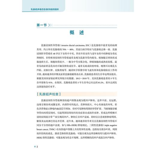 乳腺癌多模态影像学病例精粹/吕淑懿/张威主编/浙江大学出版社 商品图1