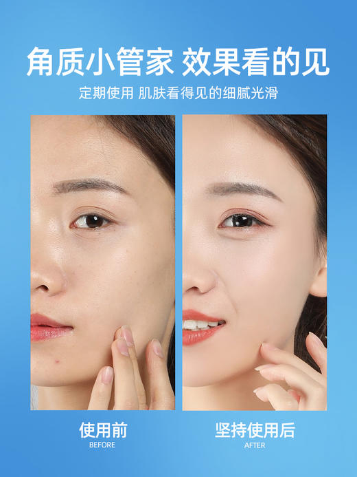 Cure 活性化水素去角质凝胶 多规格 商品图10