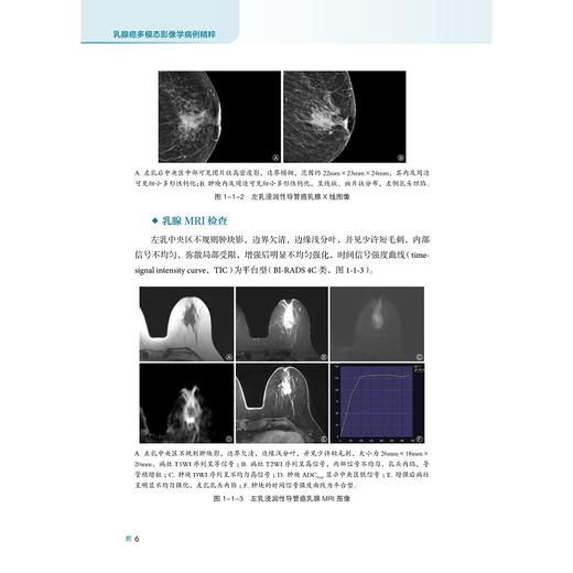 乳腺癌多模态影像学病例精粹/吕淑懿/张威主编/浙江大学出版社 商品图4