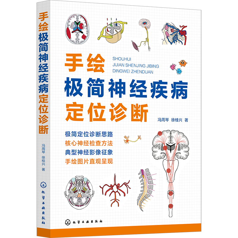 手绘极简神经疾病定位诊断