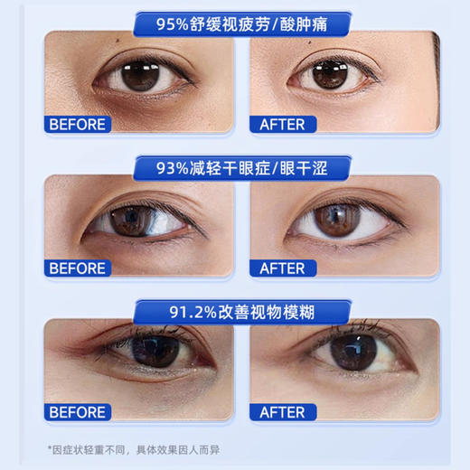 凝练 医用热敷眼罩 商品图2