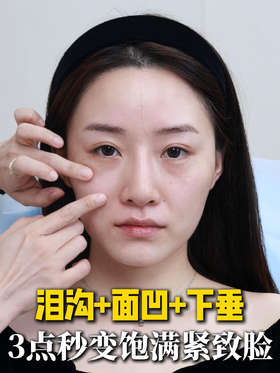 别再乱填泪沟了！中面部这样调，饱满又紧致