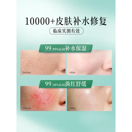 【舒缓修护】透真b5补水面膜泛醇舒缓肌肤屏障泛红可搭医面膜用晒后修复男女 商品图2