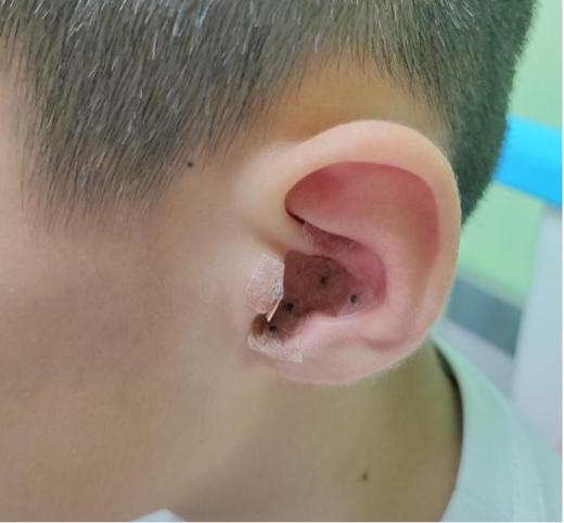 1个月亲子减重服务包-员村 商品图2