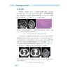 呼吸系统疾病典型案例集萃/王真 主审/吕昕/陈瑞琳 主编/浙江大学出版社 商品缩略图3